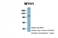 ARP42269_P050 - Myosin-1 / MYH1