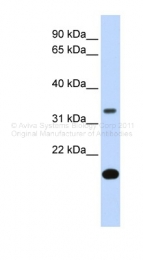 ARP42286_P050 - Follistatin