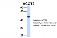 ARP42322_P050 - ACOT2