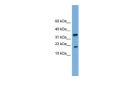 ARP42343_P050 - ACP1 / LMW-PTPase