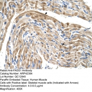 ARP42384_T100 - Fatty acid desaturase 1 (FADS1)