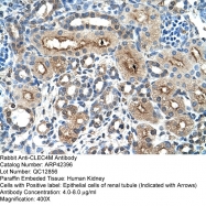 ARP42396_T100 - CD299 / CLEC4M