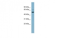 ARP42411_P050 - Angiopoietin-5