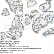 ARP42491_T100 - EPS8L1