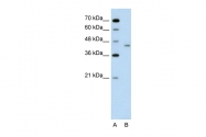 ARP42515_P050 - LRP2-binding protein / LRP2BP
