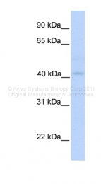 ARP42519_P050 - Gasdermin-B