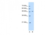 ARP42529_T100 - Cytokeratin 20