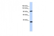 ARP42555_P050 - Pappalysin-2 / PAPPA2