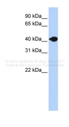 ARP42593_P050 - Deoxyribonuclease-2-beta