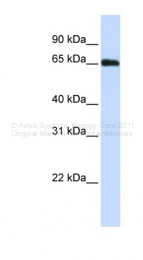 ARP42649_P050 - WDR23