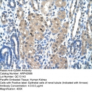 ARP42686_T100 - Granzyme H (GZMH)