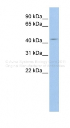 ARP42689_P050 - Autophagin-2