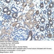ARP42694_T100 - GNAS1 / XLalphas