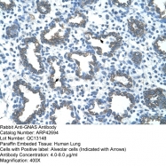 ARP42694_T100 - GNAS1 / XLalphas