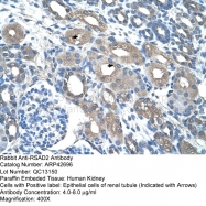 ARP42696_T100 - RSAD2 / CIG5