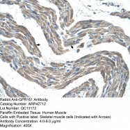 ARP42712_T100 - GPR161