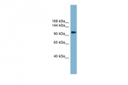 ARP42736_P050 - ATP-citrate synthase