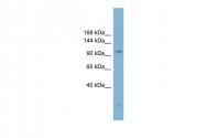 ARP42737_P050 - ATP-citrate synthase
