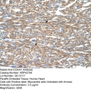ARP42784_T100 - COX IV isoform 1