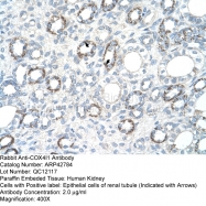 ARP42784_T100 - COX IV isoform 1