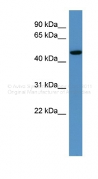 ARP42786_P050 - HDAC3
