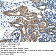 ARP42788_T100 - HDAC9