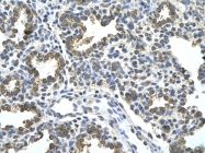 ARP42788_T100 - HDAC9