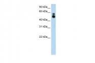 ARP42788_T100 - HDAC9