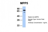 ARP42915_P050 - MPP5