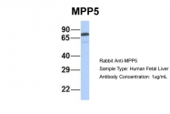 ARP42915_P050 - MPP5