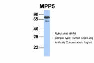 ARP42915_P050 - MPP5