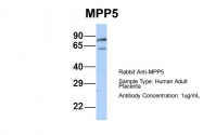 ARP42915_P050 - MPP5