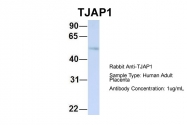 ARP42925_P050 - TJAP1