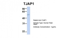 ARP42925_P050 - TJAP1