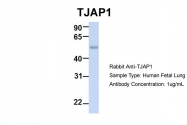 ARP42925_P050 - TJAP1