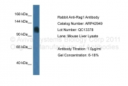 ARP42949_P050 - RAG1 / RNF74