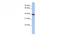 ARP42968_P050 - Cystatin-C