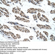 ARP43165_T100 - RNF40