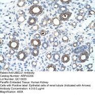 ARP43206_T100 - UBE2J1