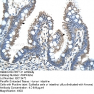 ARP43252_T100 - RNF121