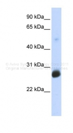 ARP43263_P050 - RNF186