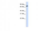 ARP43330_P050 - TRIM45 / RNF99