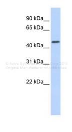 ARP43397_P050 - RNF133