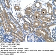 ARP43419_P050 - RNF165