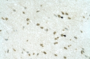 ARP43433_P050 - RNF168