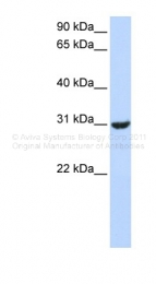 ARP43439_P050 - RNF182