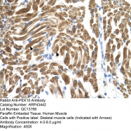 ARP43442_P050 - Peroxin 10 / PEX10 / RNF69