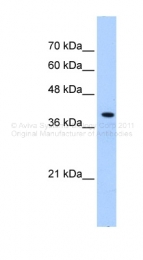 ARP43442_P050 - Peroxin 10 / PEX10 / RNF69