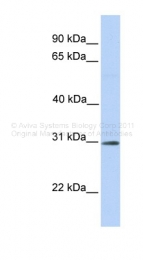 ARP43494_P050 - RNF148