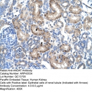 ARP43534_T100 - AADAT